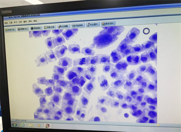 有丝分裂 分裂像.png